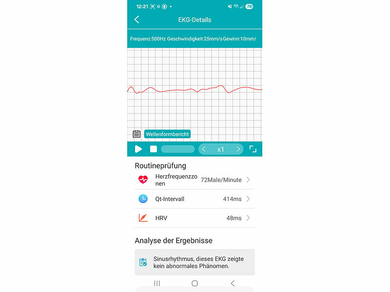 ; Fitness-Armbänder mit Blutdruck-Anzeige und EKG-Aufzeichnung Fitness-Armbänder mit Blutdruck-Anzeige und EKG-Aufzeichnung Fitness-Armbänder mit Blutdruck-Anzeige und EKG-Aufzeichnung 