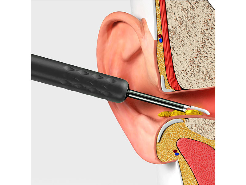 Nettoyeur d'oreille connecté avec caméra Full HD WOR-50